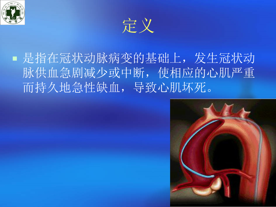 心肌梗死2015年8月科室业务学习.ppt_第1页