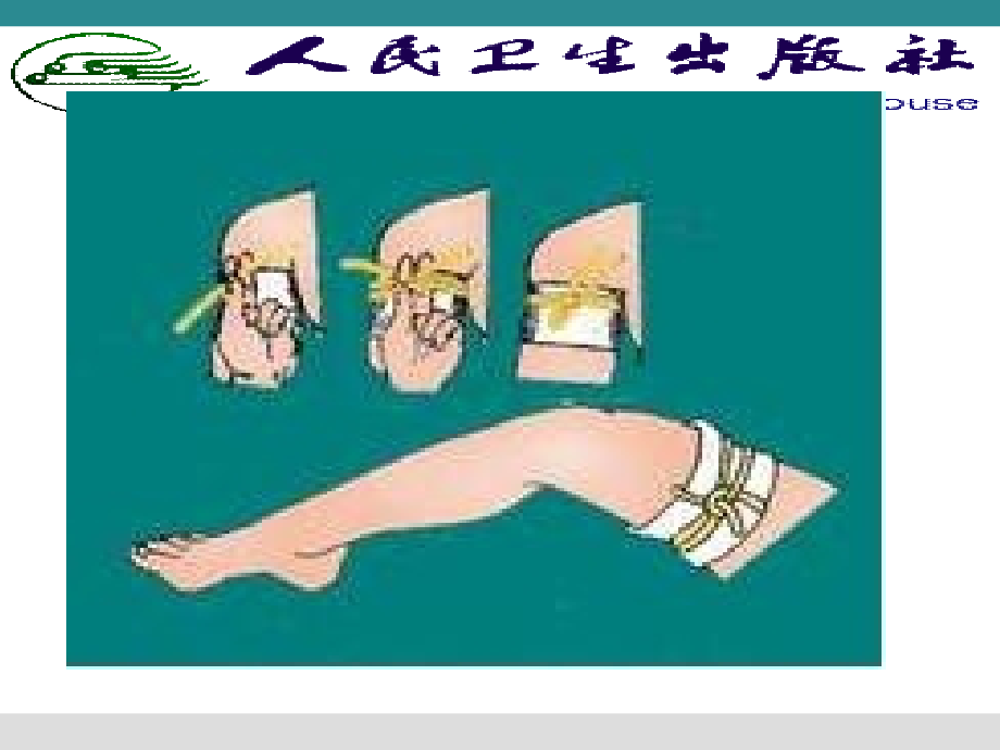 止血包扎固定搬运术.ppt_第2页