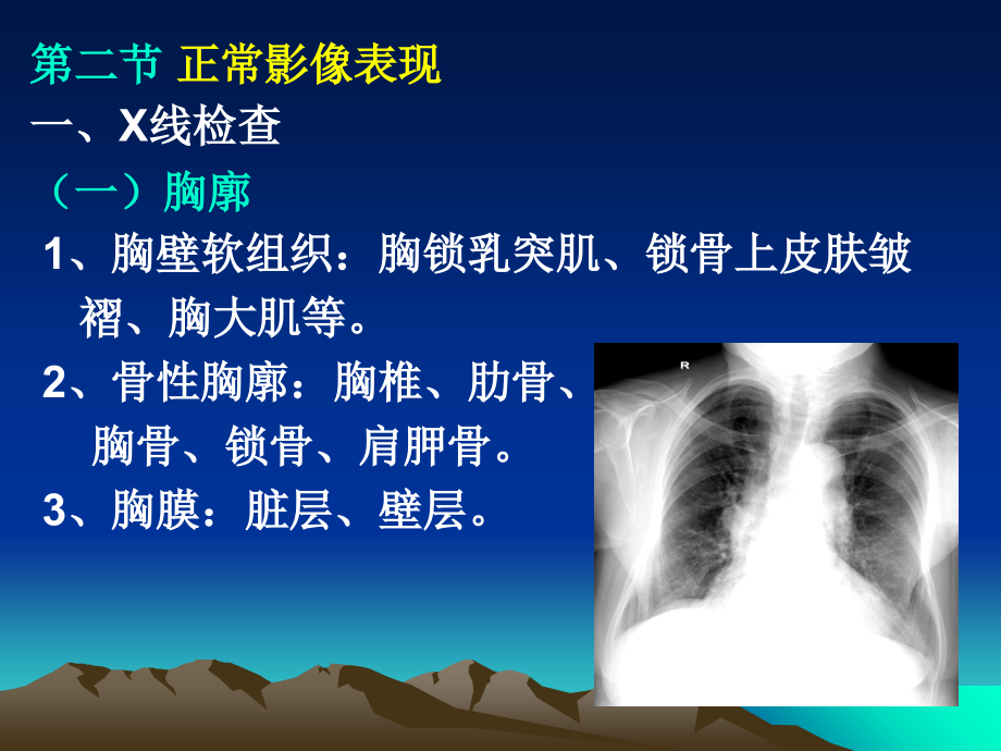 医学影像学第5次课.ppt_第2页