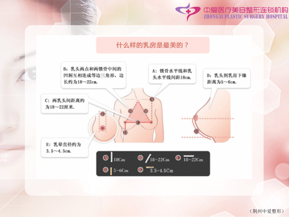 丰胸整形.ppt_第2页