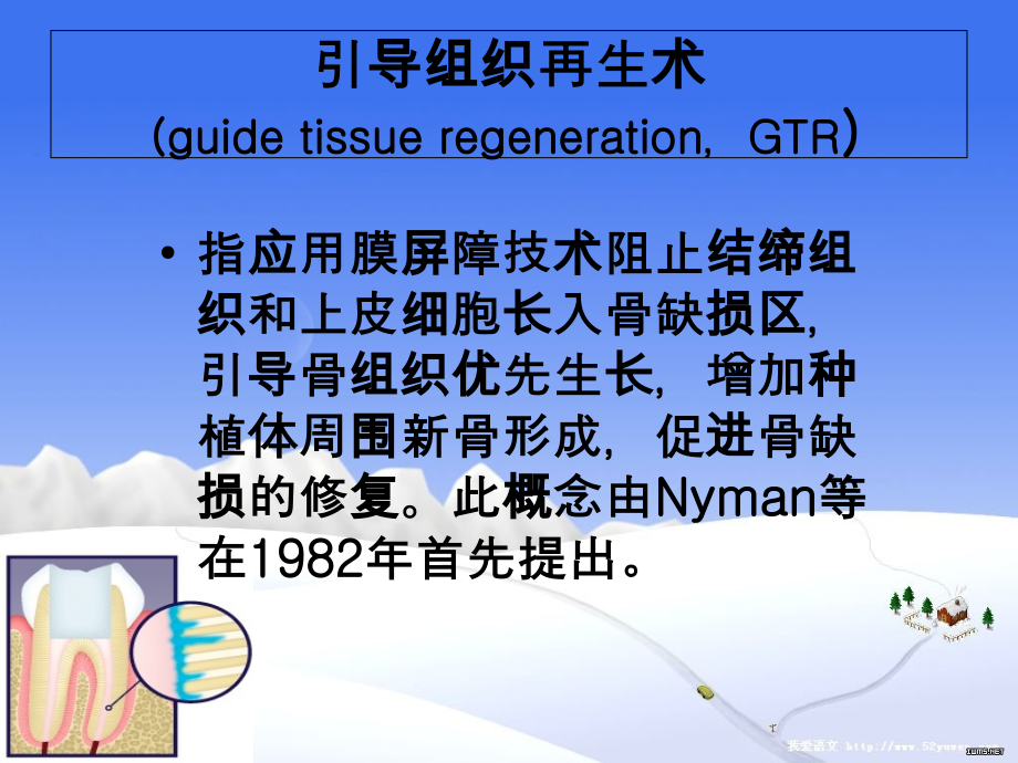 引导组织再生术的研究进展.ppt_第2页