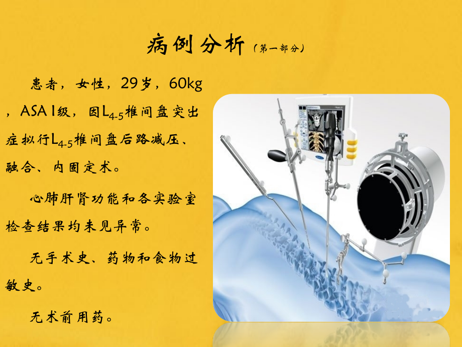 围术期过敏反应及其处理.pptx_第2页