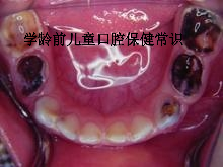学龄前儿童口腔保健常识.ppt_第1页