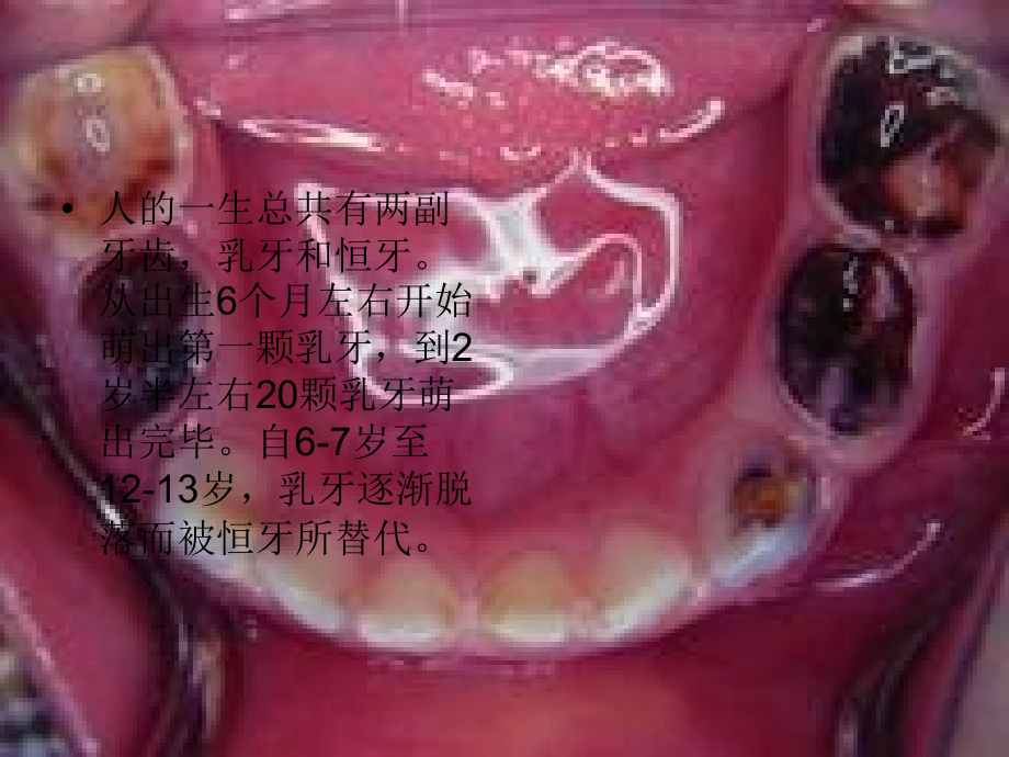 学龄前儿童口腔保健常识.ppt_第2页