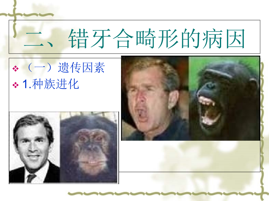 口腔正畸学第二章-错牙合畸形的发病机制及病因.ppt_第2页