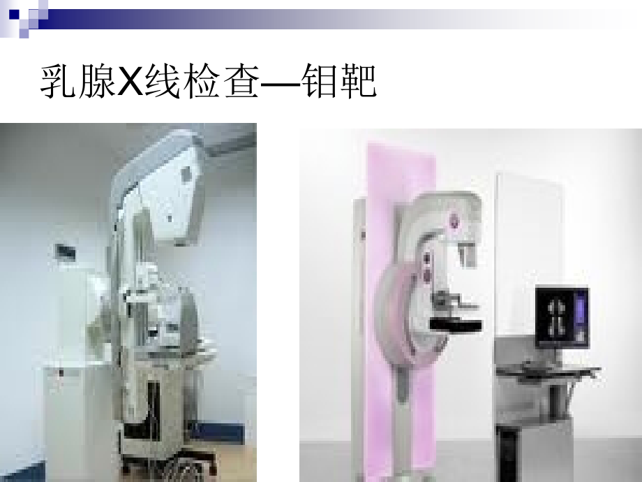 乳腺X线检查.pptx_第2页
