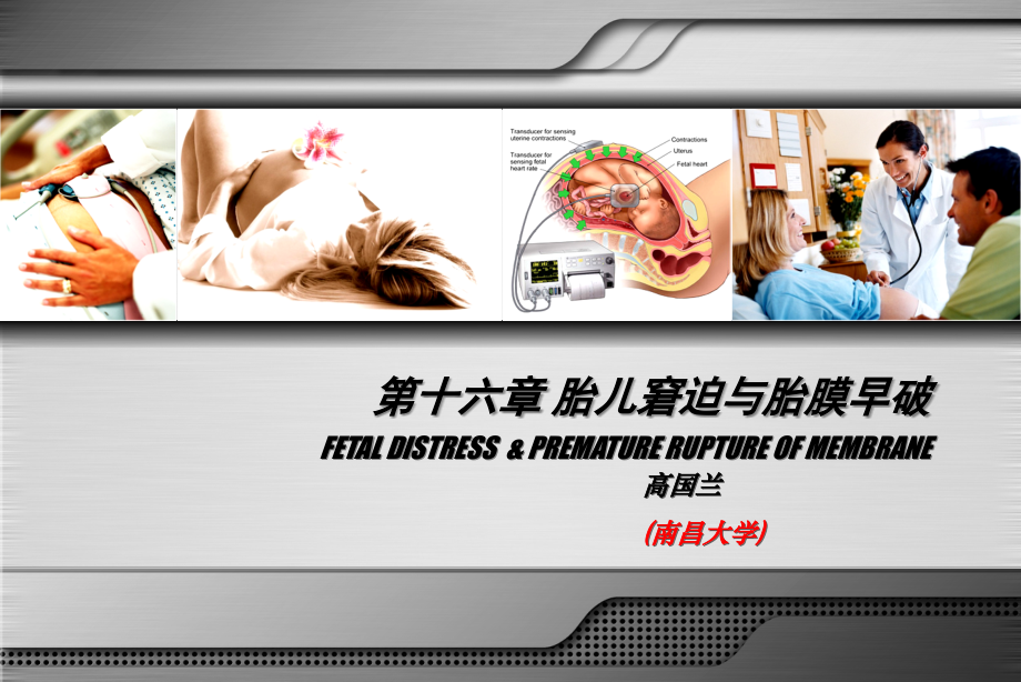 妇产科-胎儿窘迫+胎膜早破.ppt_第1页