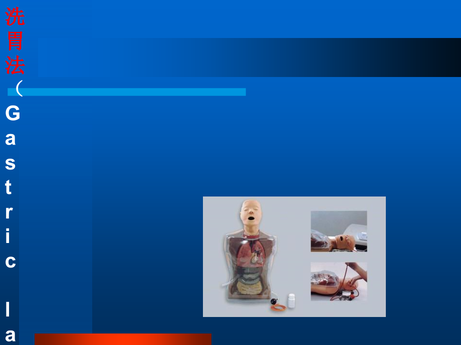 有效洗胃.ppt_第1页