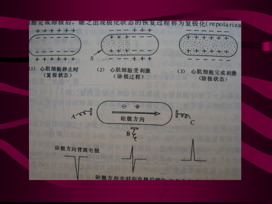 常见心电图.ppt_第2页