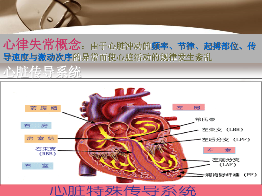心律失常介入治疗及护理(学生)新.ppt_第2页