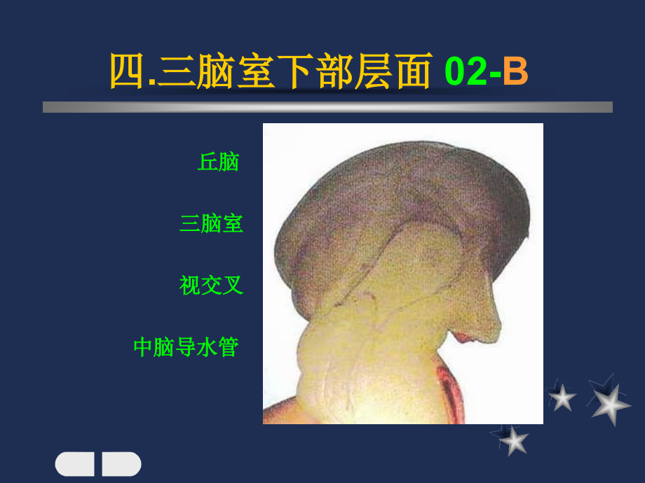 小儿头颅CT图谱3.ppt_第2页