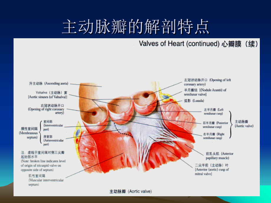 主动脉瓣疾病.ppt_第2页