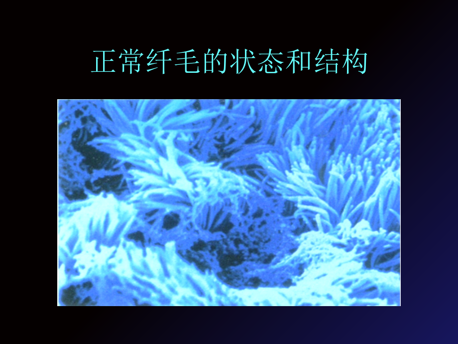 哮喘COPD的诊治新进展.ppt_第1页