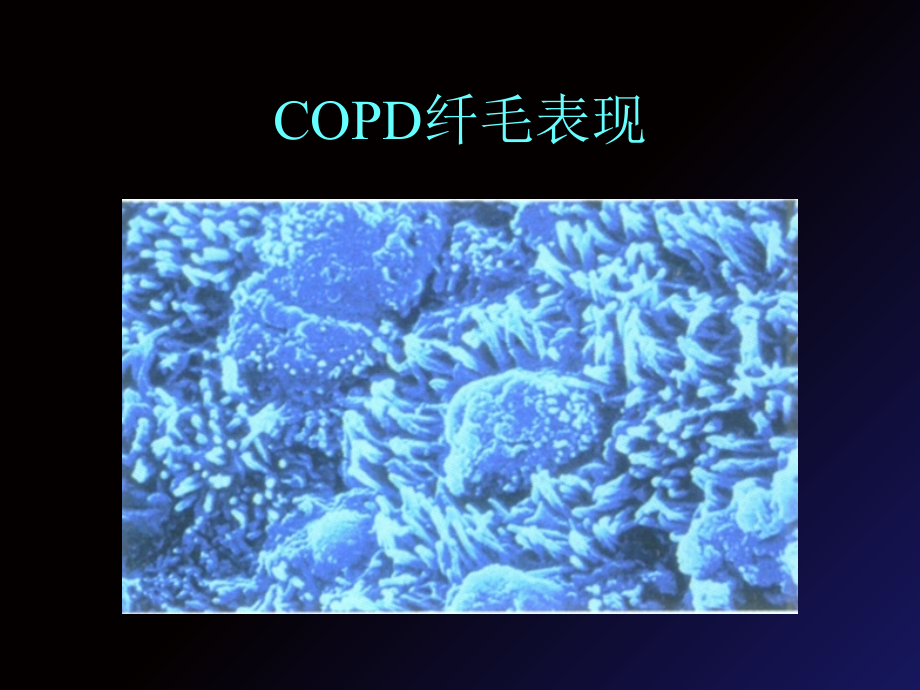 哮喘COPD的诊治新进展.ppt_第2页