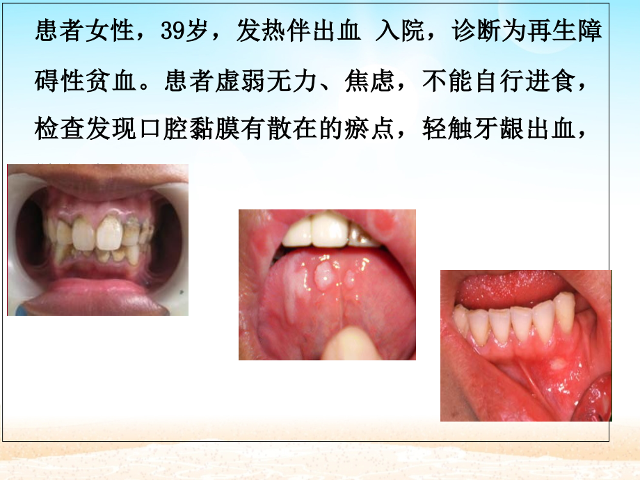 口腔相关的护理及操作.ppt_第1页