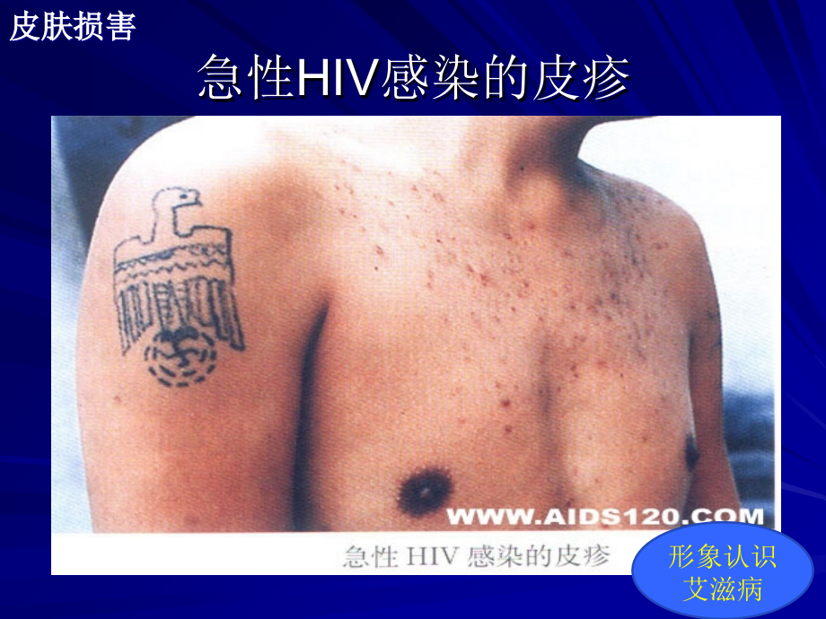 医疗机构反歧视宣传与职业暴露培训.ppt_第1页