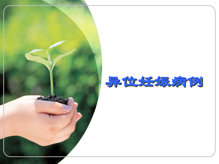 异位妊娠病例.ppt_第1页