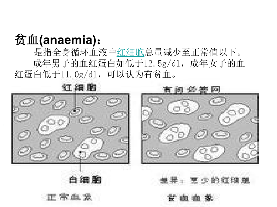 人体作业-贫血.ppt_第1页
