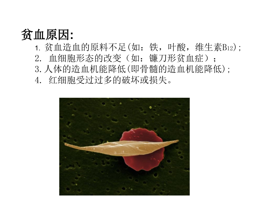 人体作业-贫血.ppt_第2页