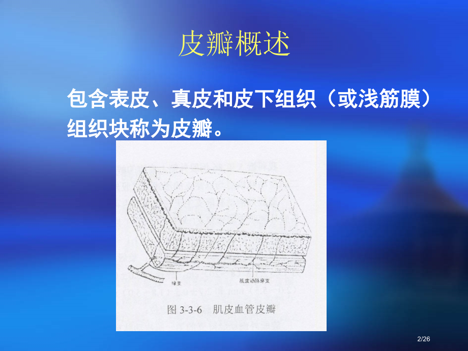 足背皮瓣教学.pptx_第2页