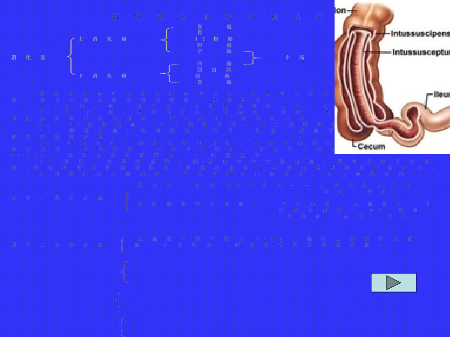 下消化道大出血.ppt_第2页