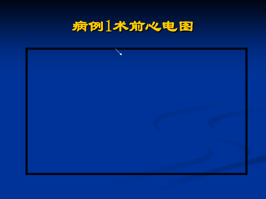 射频消融实战演练4---副本.ppt_第2页