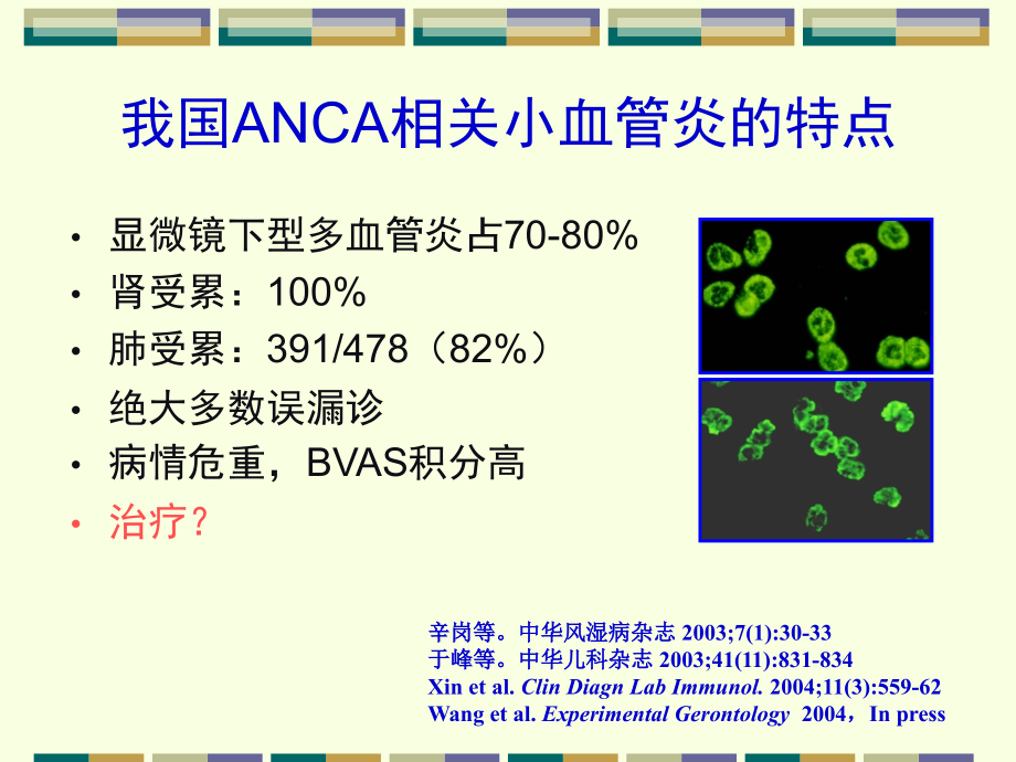 ANCA相关小血管炎治疗的循证医学证据-20分钟.ppt_第2页