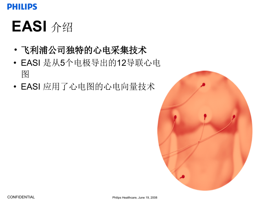 Holter动态心电介绍.ppt_第2页