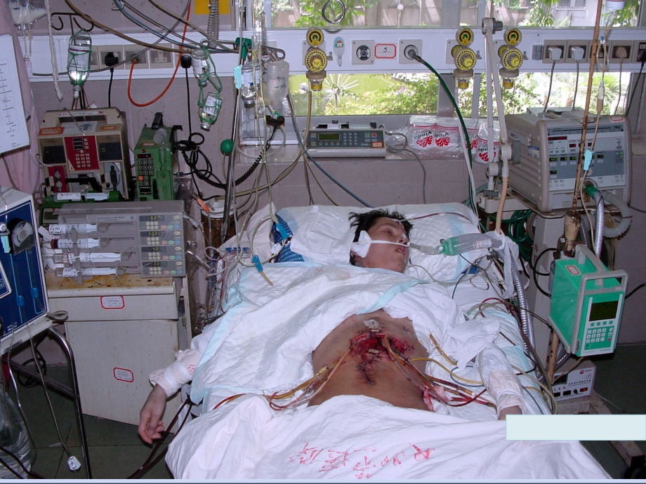 MODS09麻醉.ppt_第1页