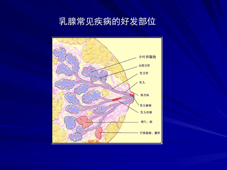 乳房疾病(本科)幻灯片.ppt_第2页