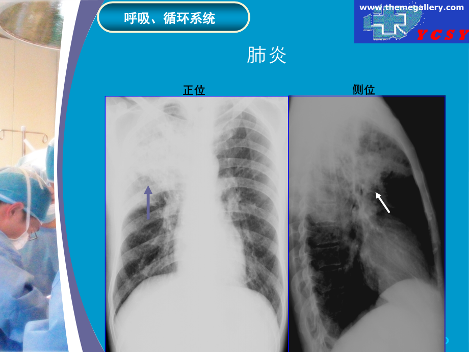 急诊X线读片.ppt_第2页
