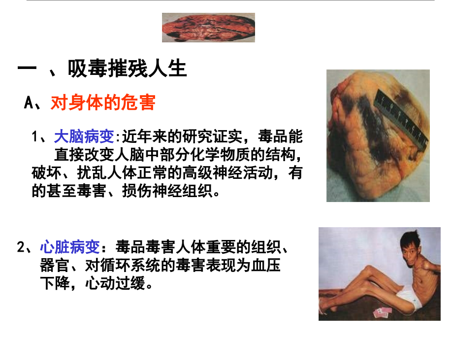 小学主题班会《珍爱生命-远离毒品》.ppt_第2页