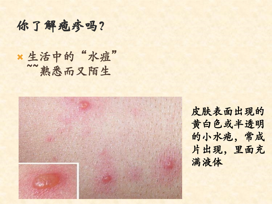 疱疹病毒完整-2.ppt_第2页