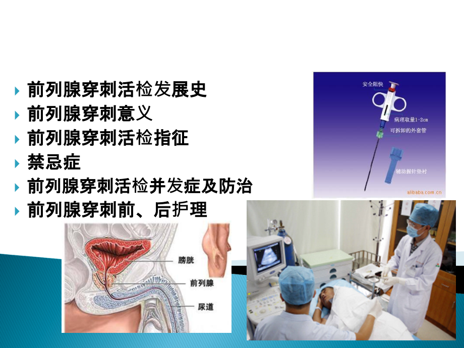 前列腺穿刺活检幻灯片.ppt_第1页