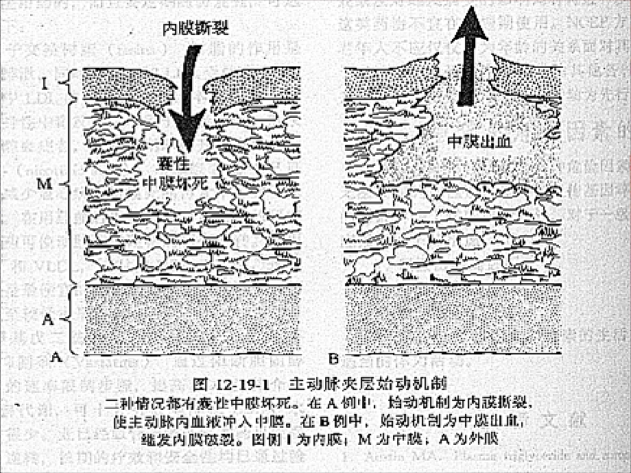 主动脉的诊治.ppt_第2页