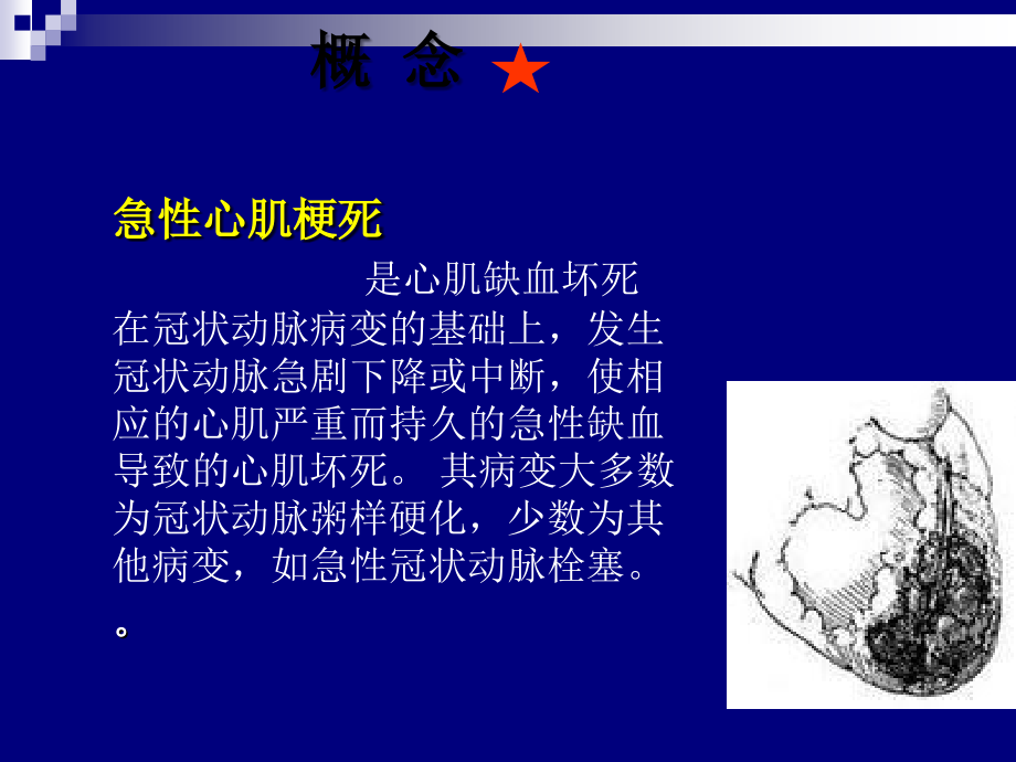 急性心肌梗塞医疗护理和查房.ppt_第2页