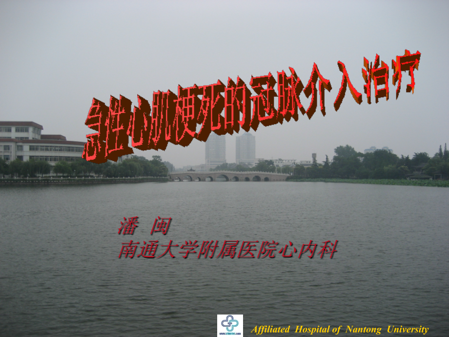 急性心肌梗死的冠脉介入治疗.ppt_第1页