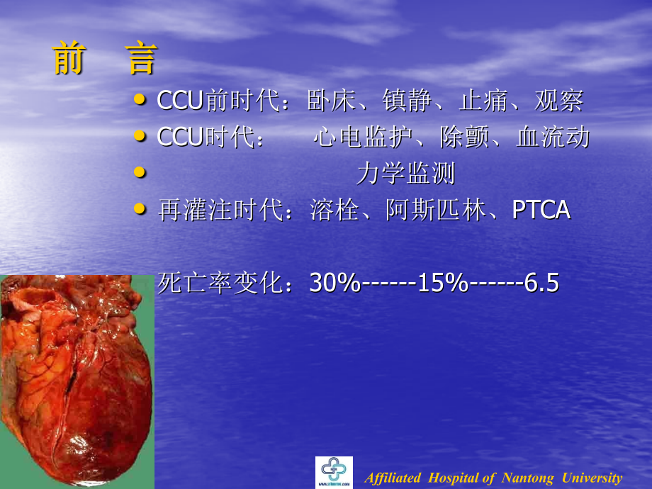 急性心肌梗死的冠脉介入治疗.ppt_第2页