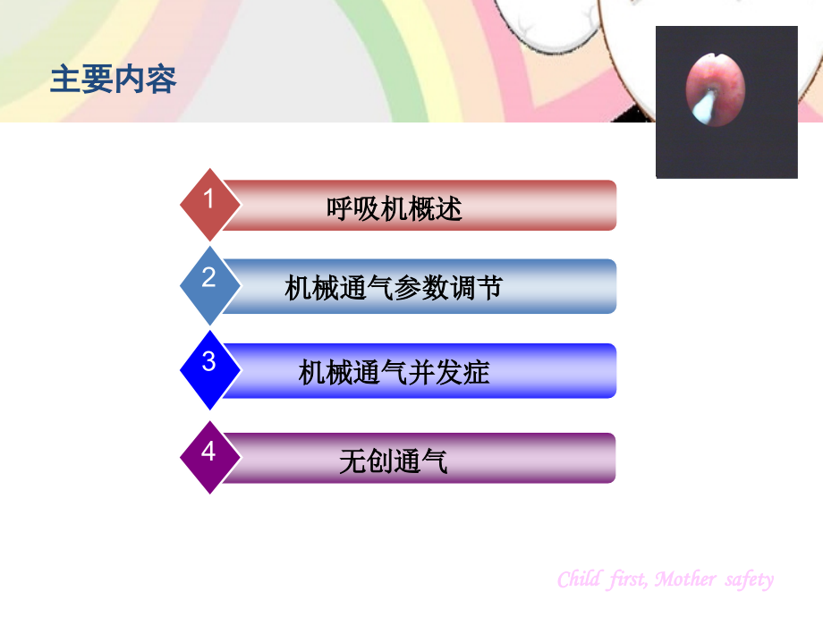 小儿机械通气的管理2.ppt_第1页