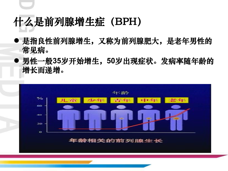 前列腺增生课件.ppt_第2页