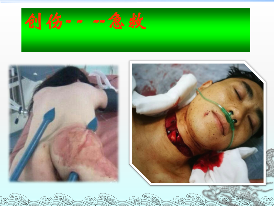 创伤总论[幻灯].ppt_第1页