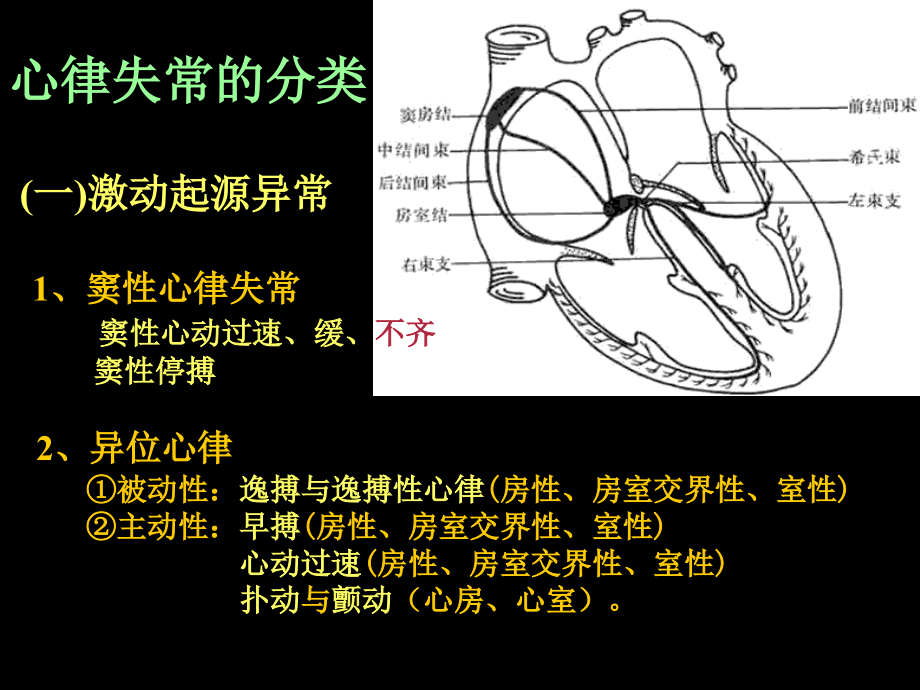 心电图3—心律失常.ppt_第2页