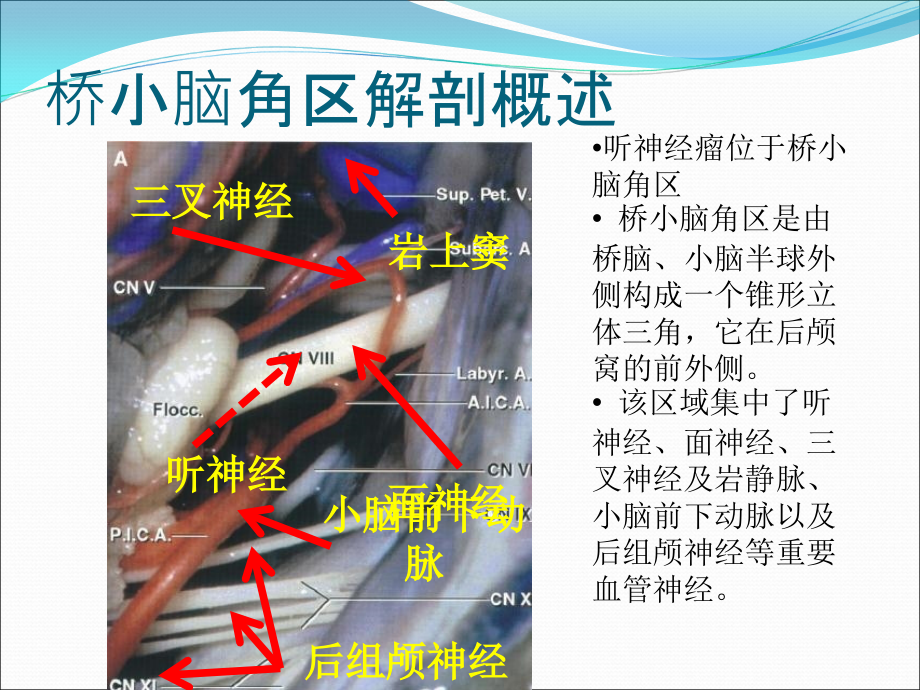 听神经瘤围手术期护理.ppt_第2页