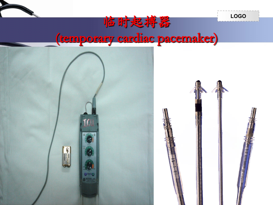 案例分析心内科.ppt_第2页