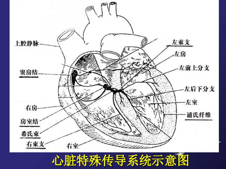 心电图幻灯片详解.ppt_第1页