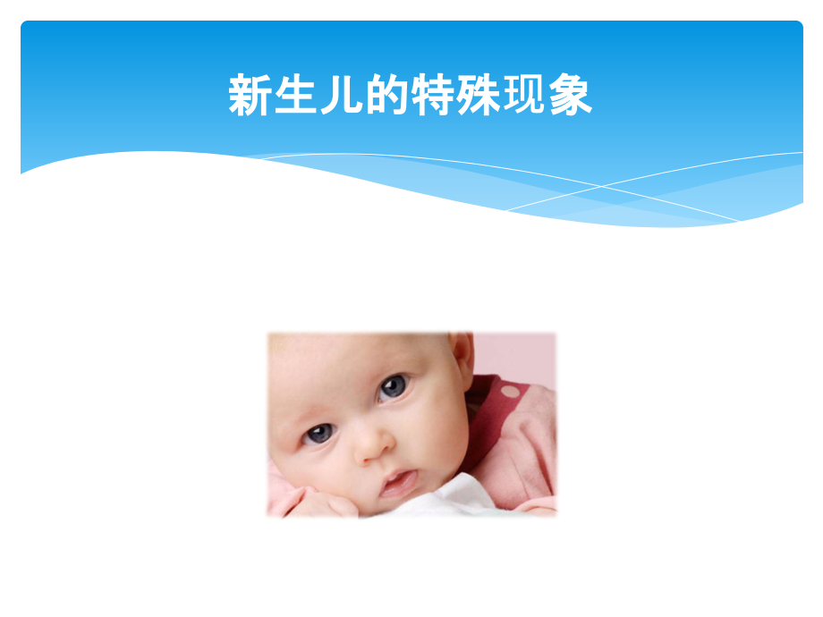 婴幼儿常见问题及医疗护理.ppt_第2页