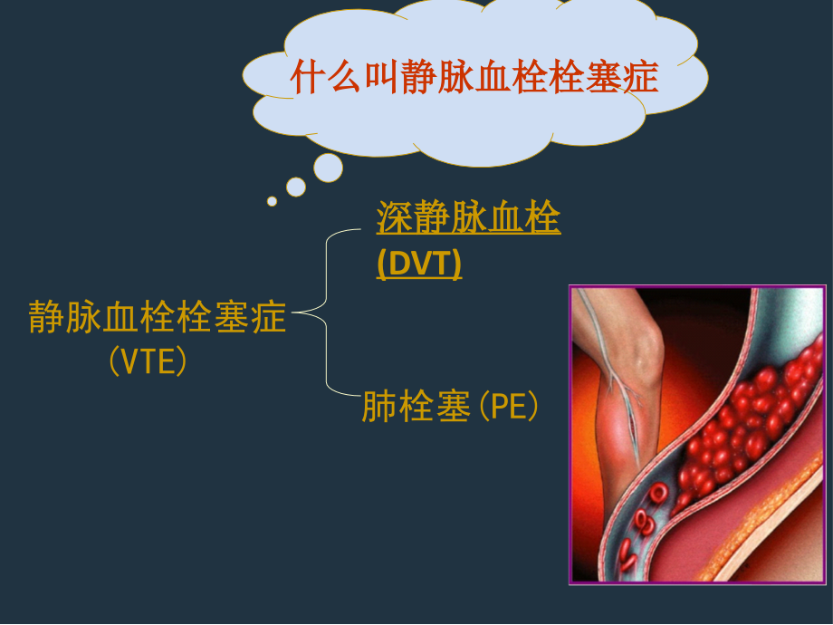 危重病人的防栓治疗与护理.ppt_第1页