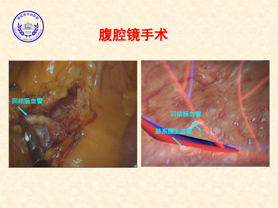 加速康复治疗3.ppt_第2页