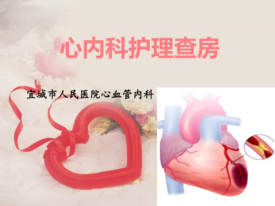 心梗病人护理和查房.pptx_第1页