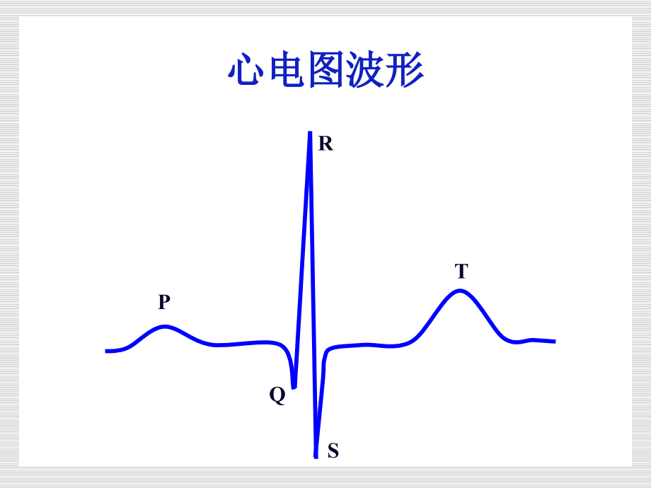 心电图的正确识别.ppt_第2页